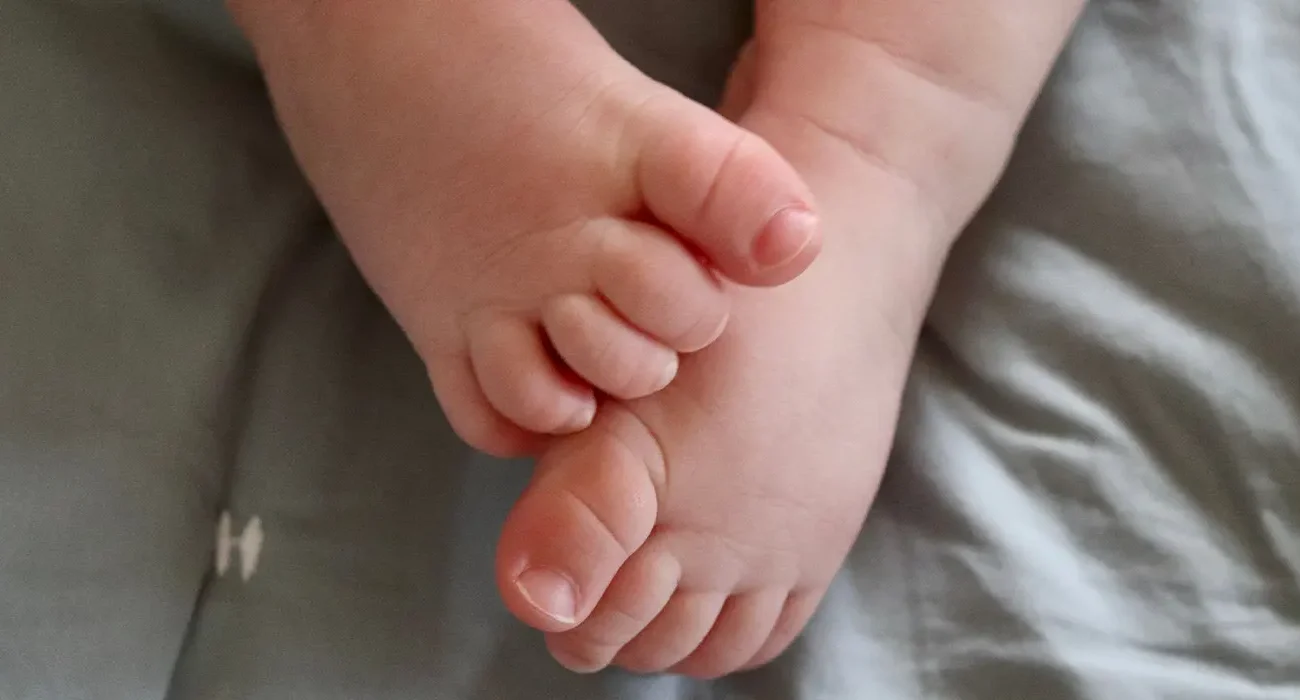 La sindattilia è una malformazione congenita (presente dalla nascita) che consiste nella fusione di due o più dita delle mani o dei piedi.