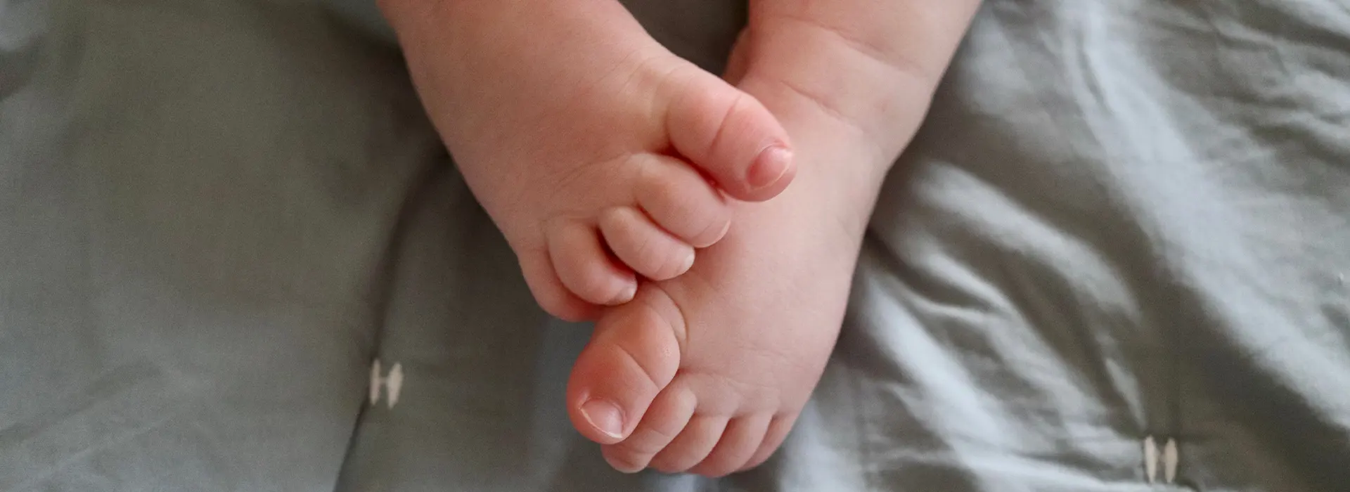 La sindattilia è una malformazione congenita (presente dalla nascita) che consiste nella fusione di due o più dita delle mani o dei piedi.